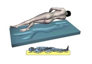 Viscoelastische Matratze bei Rückenschmerzen